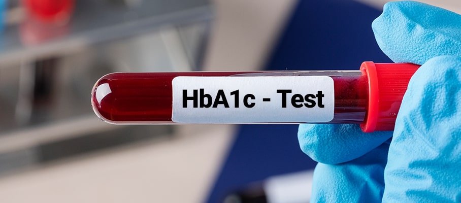 Mi az a HbA1c? - Your Allulose Store
